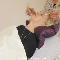 Facelifting-Kieferbalance