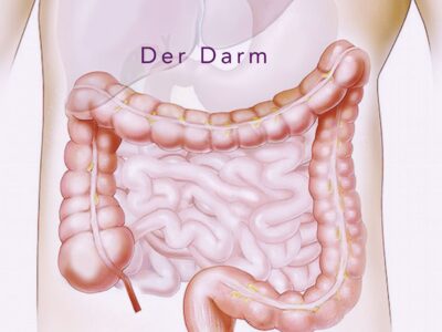 Ascension-Darm-Deutsch-scaled-400x300